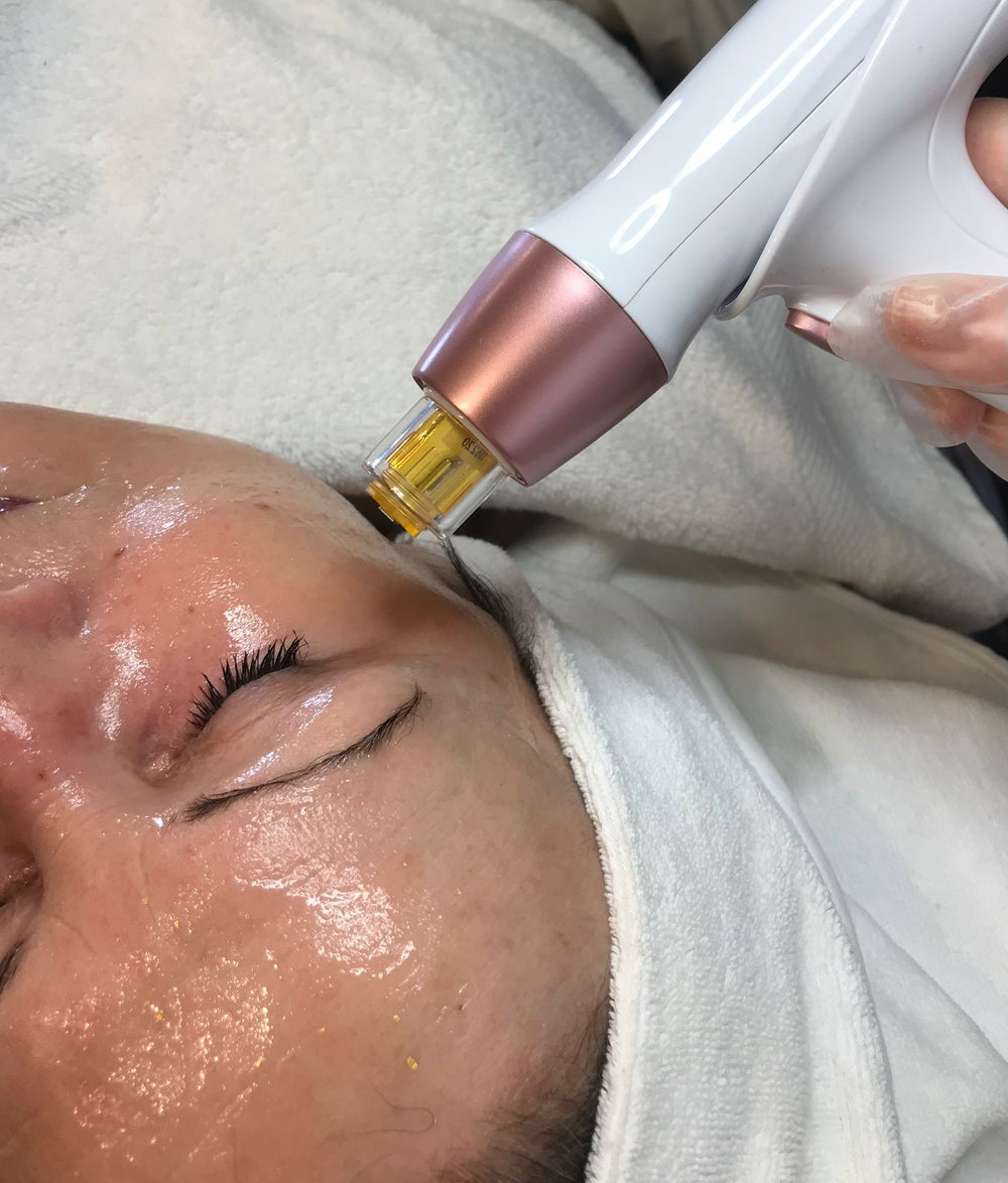 Nano Needling 2.0 - SkinThings