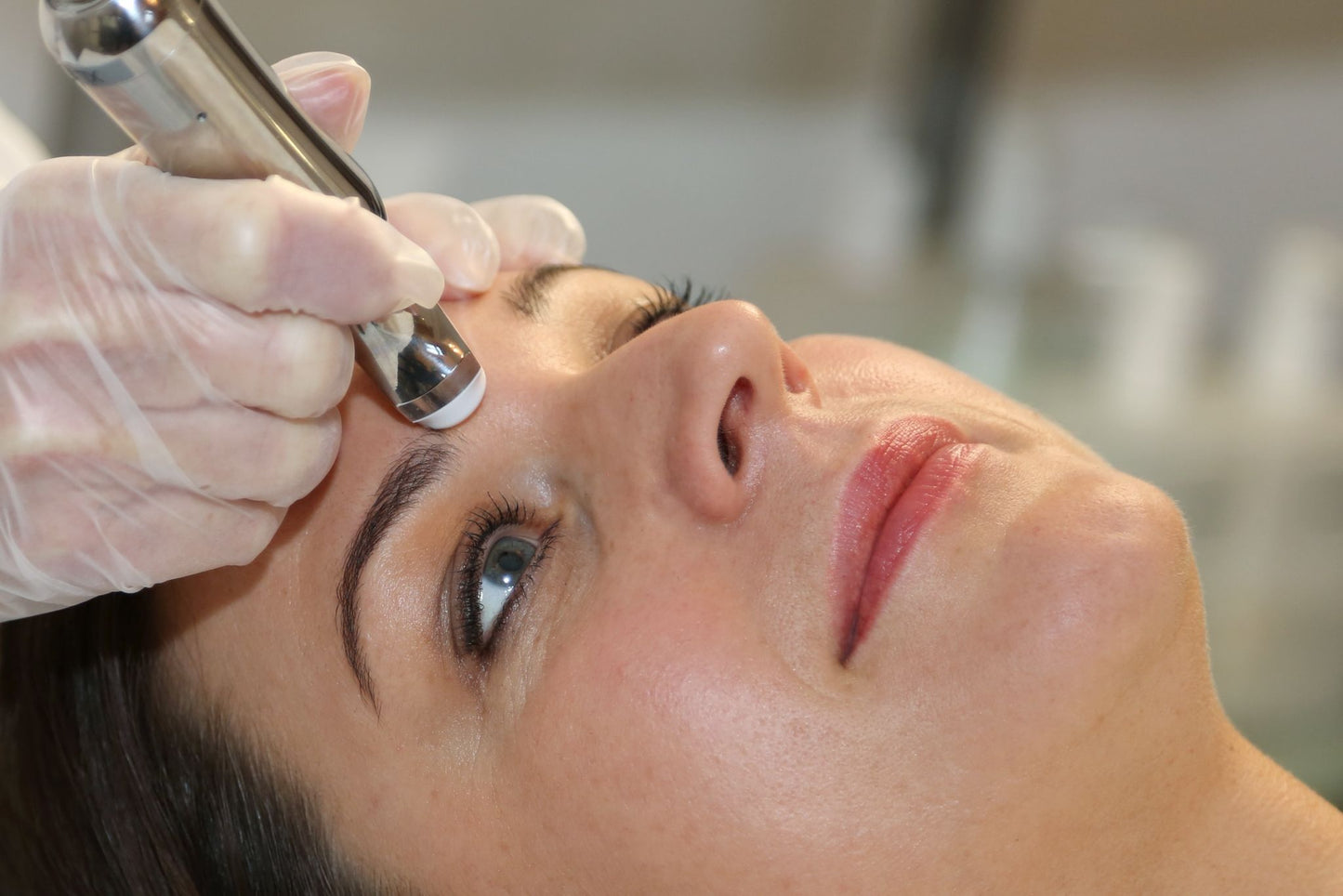 Mikroneedling - SKIN SKINGS